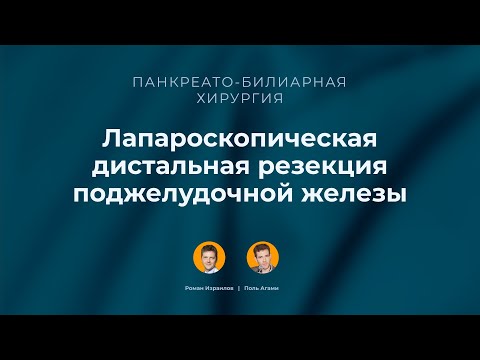 Лапароскопическая дистальная резекция поджелудочной железы