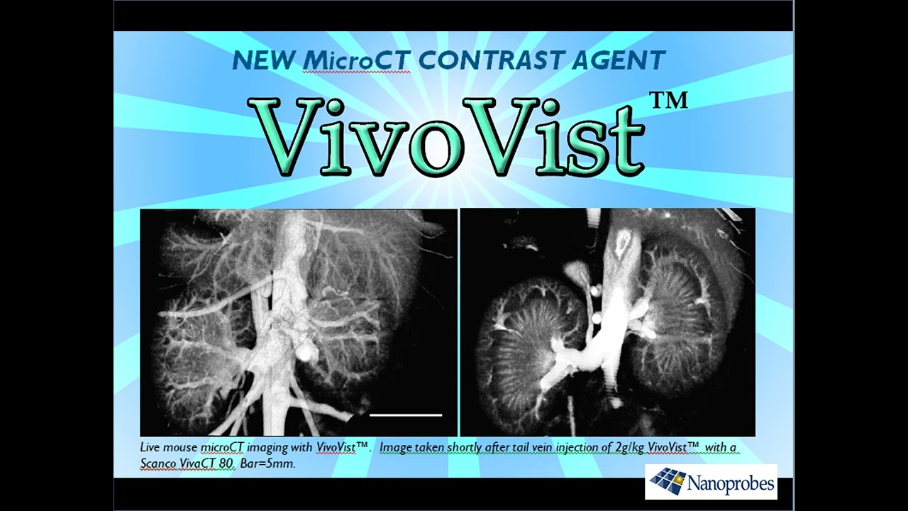 VivoVist™: Reimagine Micro-CT