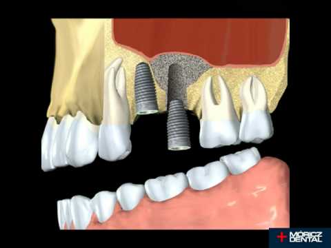 Móricz dental