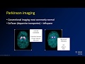 Neuroradiology board review lecture 1 neurodegenerative review