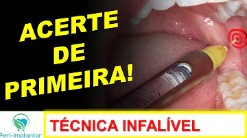 O que fazer quando a gengiva solta do dente?