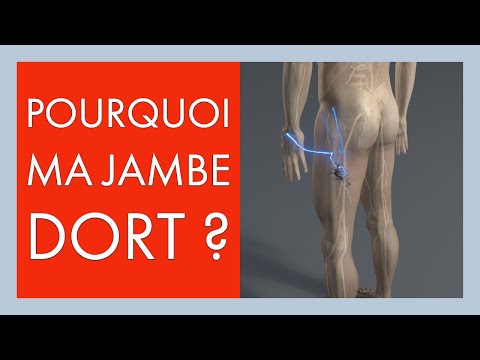 Paresthésie, perte de sensibilité, fourmillements jambe ou pied: pourquoi ma jambe dort ?