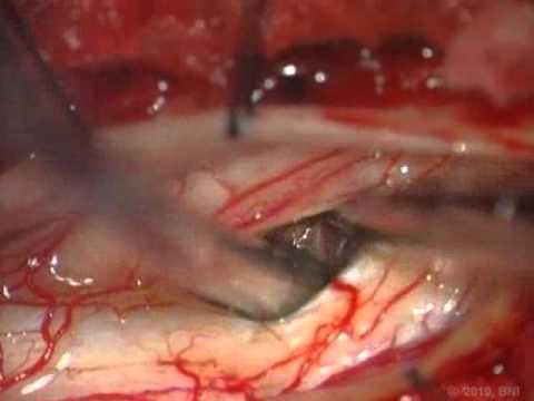 NEUROSURGERY Journal