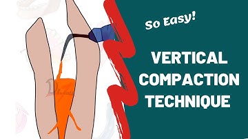 Obturation Techniques in Endodontics