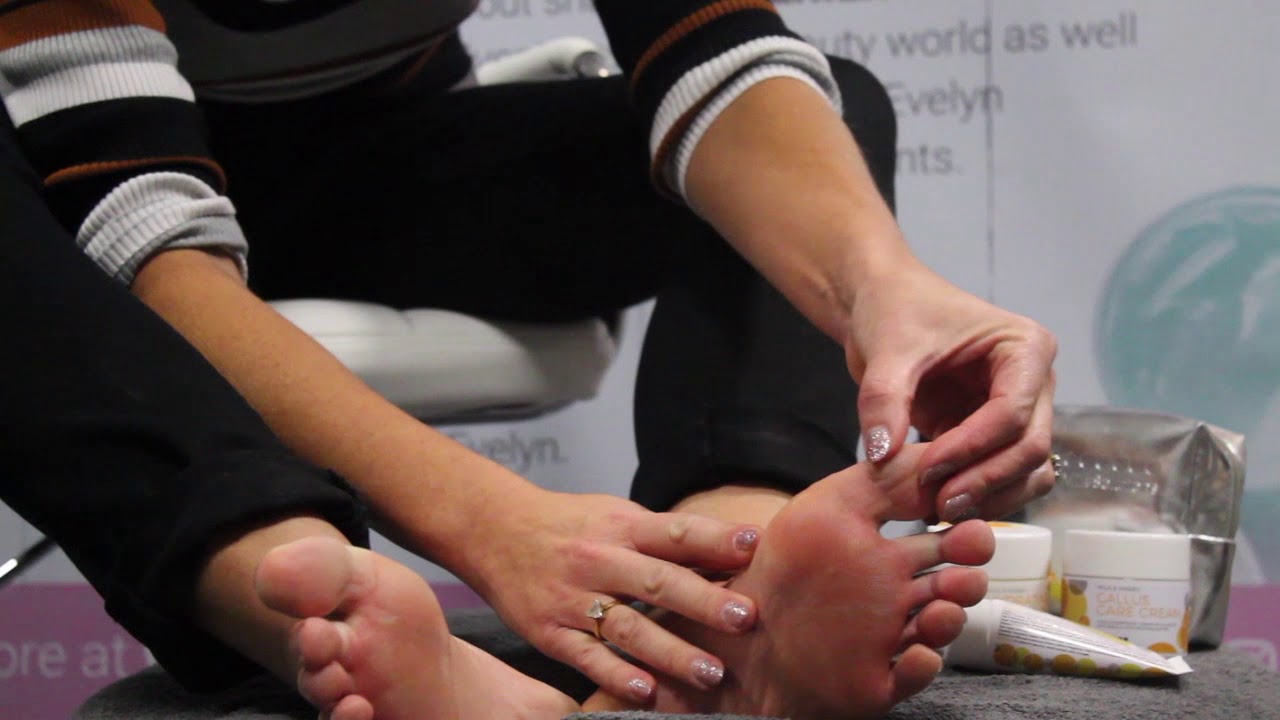 Milk Solutions the NEW Callous Care Cream (foot peel) Launch