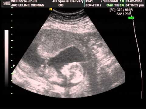 14 week ultrasound boy youtube