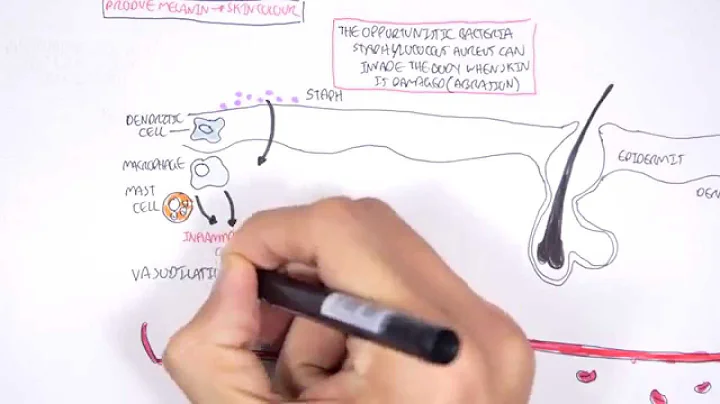 Microbiology - Staphylococcus Aureus and Skin Absc...