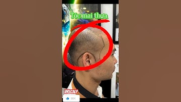 Cách sử lý khi thợ cắt tóc bó tay, tóc thưa hói tóc mai #xămtóc #scalp
