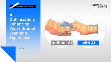 Intraoral Scan Course EP12｜AI Optimization｜Scan Process