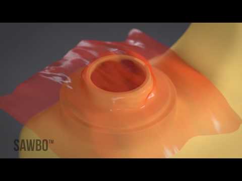 SAWBO - Postharvest Loss: Hermetic Sealing with Locally Available Containers