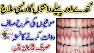 Teeth Whitening tips | Daant saaf karne ka Tarika | Peele Daant | Teeth Problem | short video