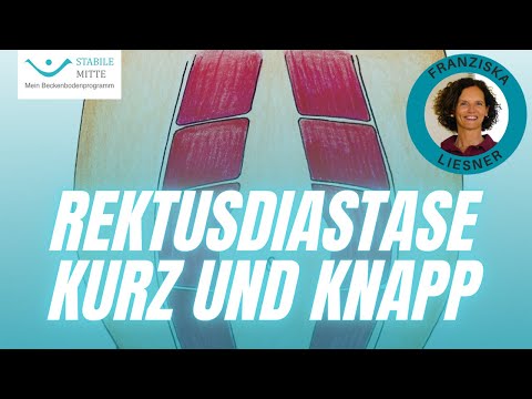 Rektusdiastase kurz und knapp