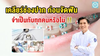 เคลียร์ช่องปาก ก่อนจัดฟัน จำเป็นกับทุกคนหรือไม่ | หมอเคนมีคำตอบ