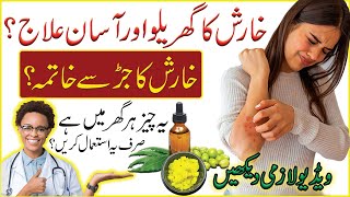 Kharish khatam karne ka tarika | Itching home treatment | Kharish ka ilaj | How to treat scabies