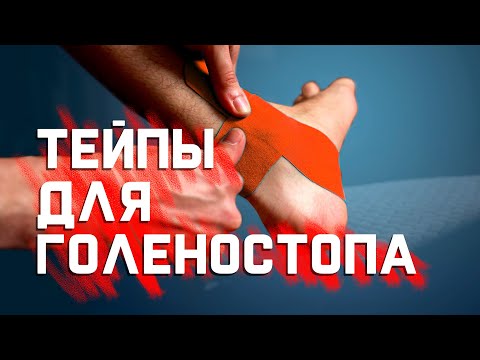 Защищаем и укрепляем голеностоп с помощью тейпов