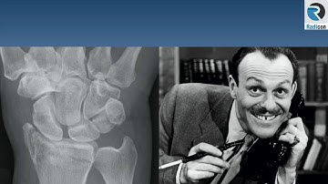 FRCR Rapid Reporting Part 3   Wrist films