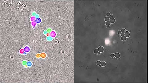 Segmentation and tracking