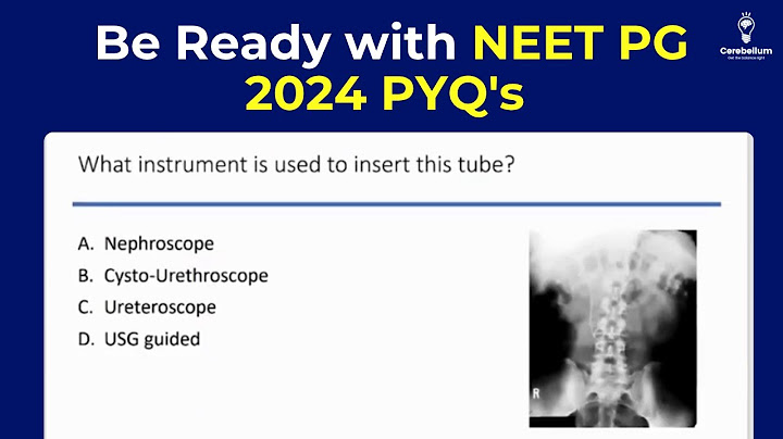 Surgery Most Important NEET PG 2024 PYQs? Be Exam Ready for 2025?