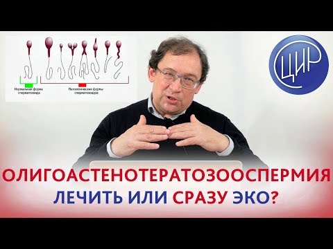 ОЛИГОастеноТЕРАТОЗООСПЕРМИЯ - лечить или ЭКО?  Морфология по Крюгеру. Отвечает доктор Гузов.