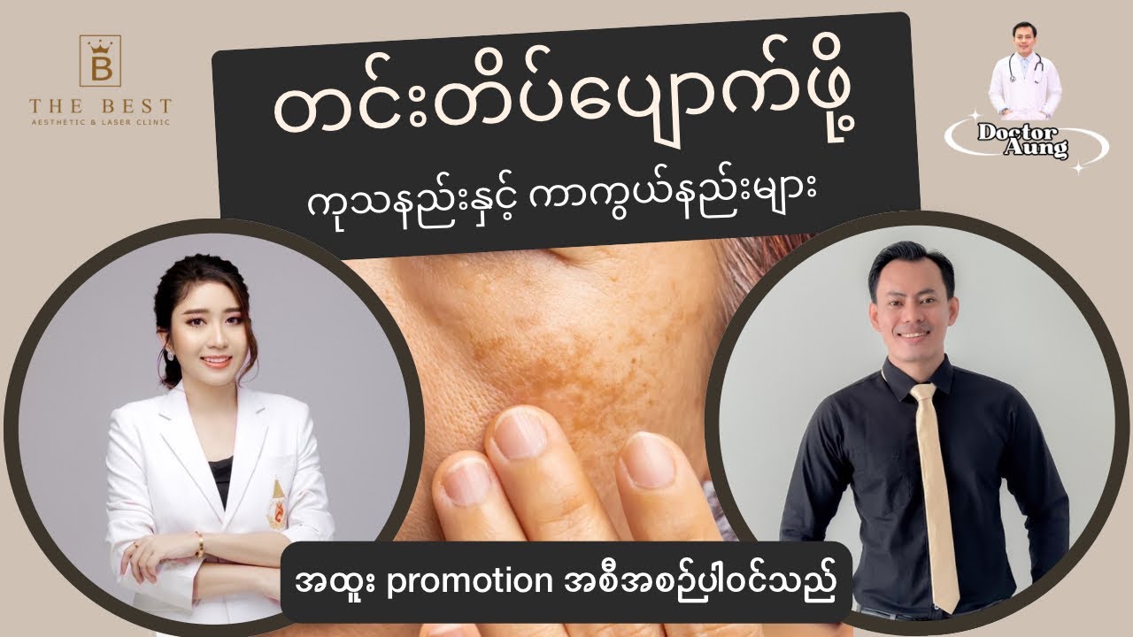 တင်းတိပ် အရေပြားပြဿနာ ကာကွယ်နည်းနှင့် ကုသနည်းများအကြောင်း | Prevention and treatment of melasma