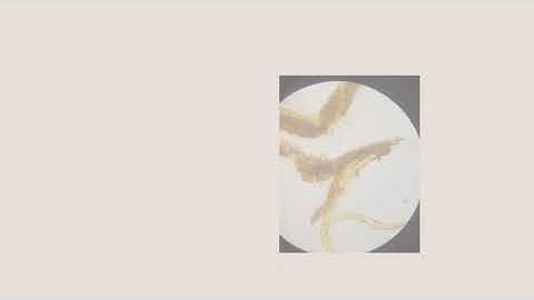 Characteristic Microscopic Key Elements of Cinchona Bark Powder