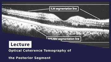 Optical Coherence Tomography of the Posterior Segment