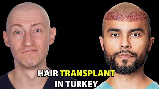 I Went To Turkey For A Hair Transplant | Hair Surgeon Reacts