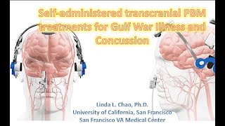 Gulf War Illness: Self-administered Transcranial PBM for Gulf War Illness and Concussion