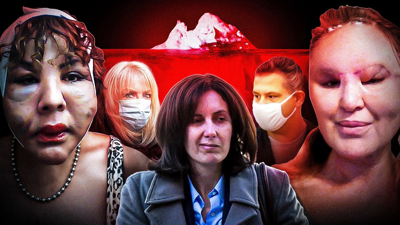 The Botched Surgeries Iceberg..
