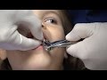 Sunshine gets her tooth pulled by the dentist with Novocain. Is she afraid?