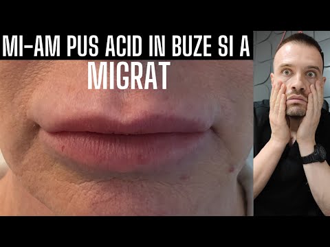 Video: Cum scap de migrarea EF?