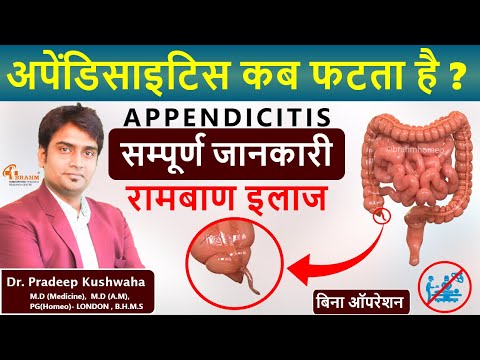 |Appendix Ka Ilaj Bina Operation | |Homeopathy