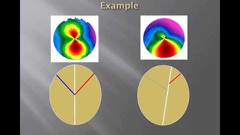 [Online Seminar] Comprehensive Management of Anterior Segment Disease with the OCULUS Pentacam®