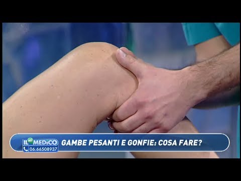 Video: Perché Le Gambe Di Donne E Uomini Si Gonfiano? 8 Motivi Per La Comparsa Di Edema Alle Gambe