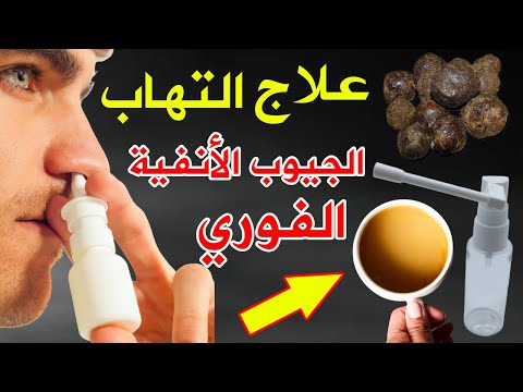 علاج الجيوب الانفية وانسداد الانف ببخاخ طبيعي من صنع يديك يعالج التهاب الجيوب ويقضى على حساسية الانف