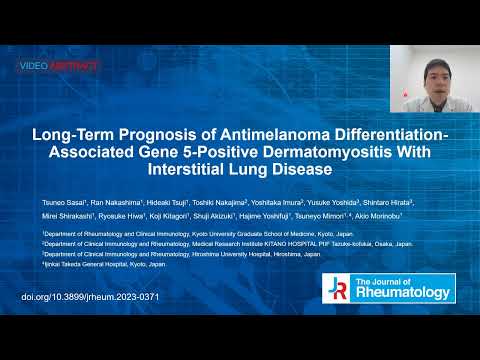 Video Abstract: Long-Term