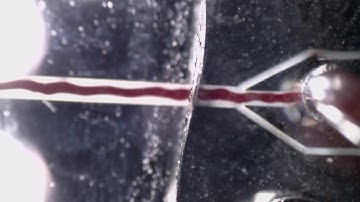 Capillary-driven and acoustophoresis-driven plasma separation