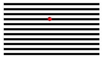 Lazy right eye exercise #17 - Amblyopia and/or strabismus - Lazy eye and eye turn