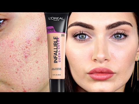 How To Cover Acne and Colour Correct Acne Scars // Collab | Ruby Golani