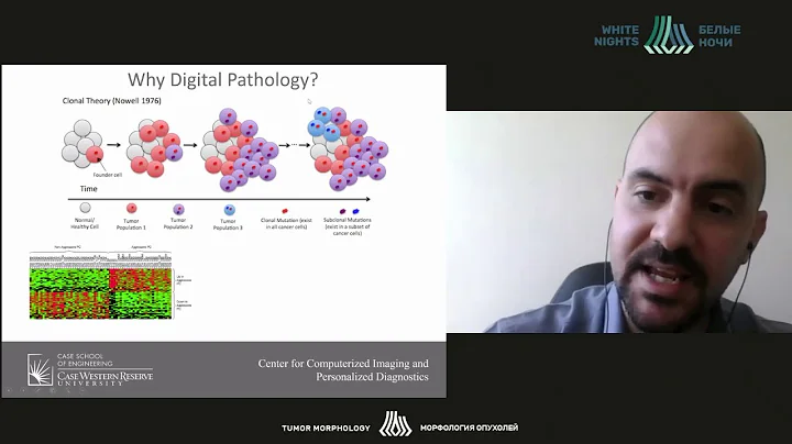 Computatonal pathology: Towards precision medicine (Andrew Janowczyk)