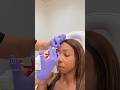 BOTOX DAY! #adayinmylife #botox #skincare #vlog