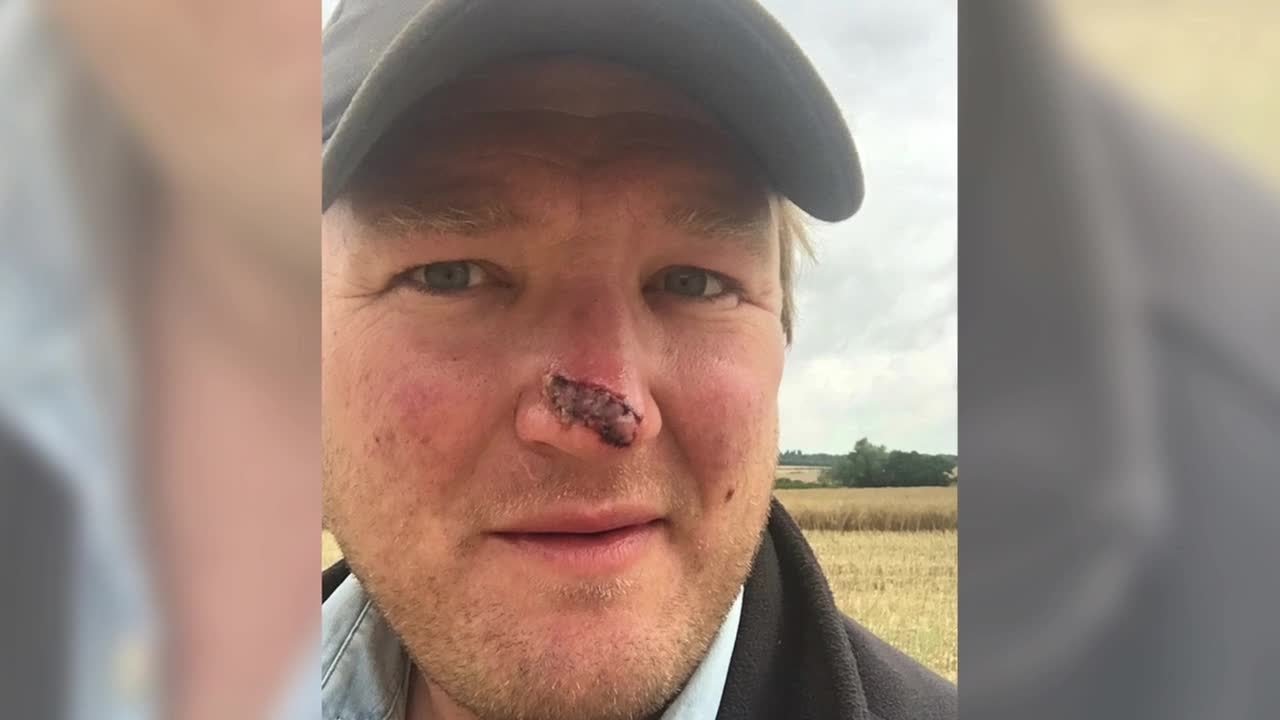 Farmer attacked with metal bar by hare coursers