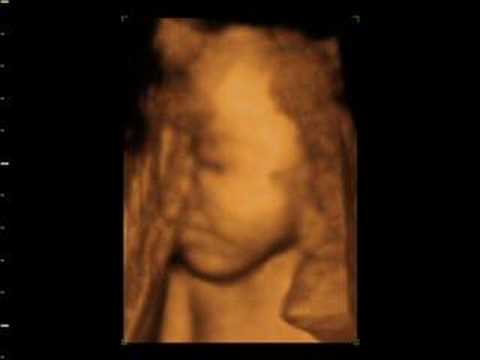 wombo combo laura and kelvin 4d baby scan