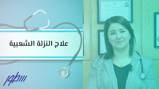 علاج النزلة الشعبية