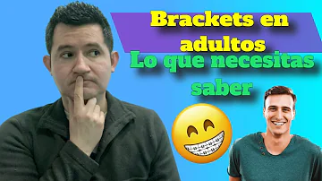 ¿Funcionan los aparatos dentales a cualquier edad?