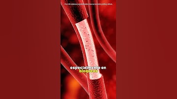 How Rotational Atherectomy Is Done? (Medical Animation 3D)#3d #didyouknow #health #3danimation