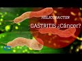 Helicobacter: principal causa de gastritis y posiblemente de cáncer