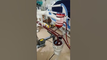 ECMO machine #hospital #medicalhealthcare #shorts #ecmo #ecmomachine #doctor #icudoctor #doctor