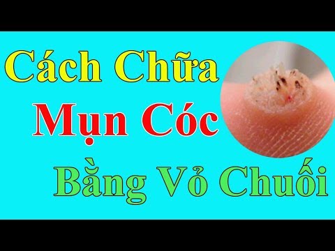 [ Hướng Dẫn ] Trị Mụn Cóc Bằng Vỏ Chuối Tại Nhà