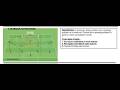 Attacking Pattern to Goal Warm Up